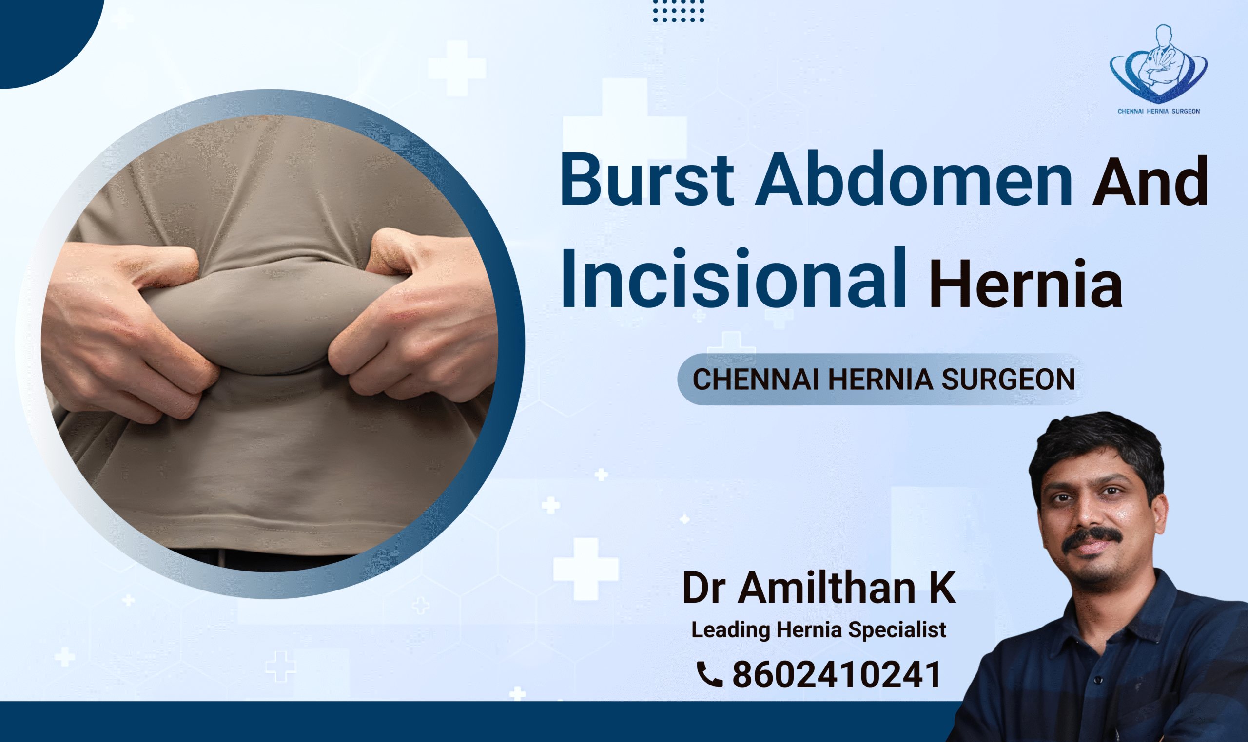 
Burst Abdomen and Incisional Hernia